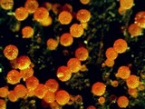 Nectria peziza image