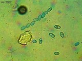 Nectria peziza image
