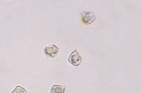 Entoloma lagenicystis image