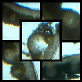 Catapyrenium squamulosum image