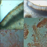 Leptogium schraderi image