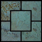 Bacidia absistens image