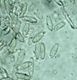 Echinoporia aculeifera image