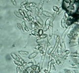 Echinoporia aculeifera image