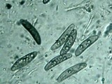 Kretzschmaria clavus image