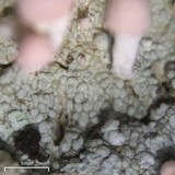 Dibaeis baeomyces image