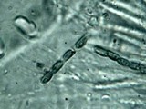 Xylaria scopiformis image