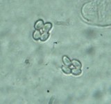 Volvariella bombycina var. flaviceps image