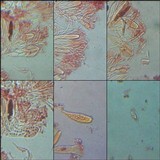 Caloplaca ochracea image