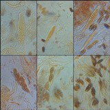Diploschistes diacapsis image