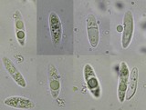 Ophioparma lapponica image
