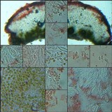 Caloplaca flavescens image