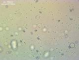 Amanita subcokeri image