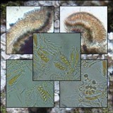 Lecanora albella image