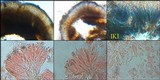 Lecidella elaeochroma f. elaeochroma image