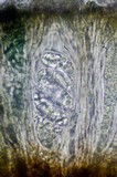 Rhizocarpon umbilicatum image