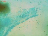 Heterogastridium pycnidioideum image