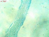 Heterogastridium pycnidioideum image