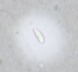 Porpidia flavocoerulescens image