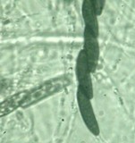 Kretzschmaria clavus image