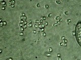 Hydnopolyporus fimbriatus image