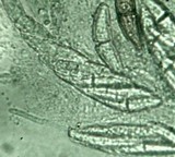 Calostilbe striispora image