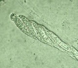 Calostilbe striispora image