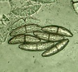 Calostilbe striispora image