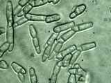 Annellodochium ramulisporum image
