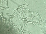 Annellodochium ramulisporum image