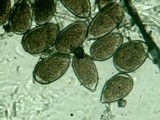 Sphaerosporium lignatile image
