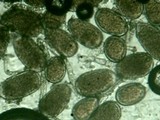 Sphaerosporium lignatile image