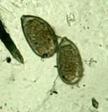Sphaerosporium lignatile image