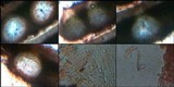 Catapyrenium squamulosum image