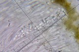 Candelariella vitellina image