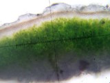 Lecidea atrobrunnea image