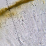 Candelariella rosulans image