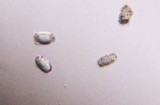 Calostoma cinnabarinum image