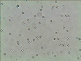 Pluteus mammillatus image