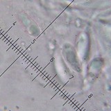 Candelariella efflorescens image
