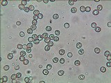 Pluteus mammillatus image