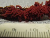 Arcyria denudata image
