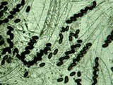 Ascobolus scatigenus image