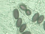 Ascobolus scatigenus image
