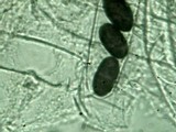 Ascobolus scatigenus image