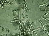 Dacryopinax elegans image
