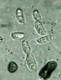 Dacryopinax elegans image