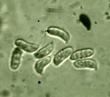 Dacryopinax elegans image