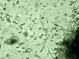 Dacryopinax elegans image