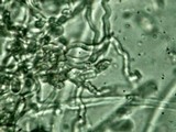 Dacryopinax elegans image